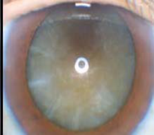 O(IQ`VS~PF`NBR@)F4N6$8F.png O(IQ`VS~PF`NBR@)F4N6$8F.png