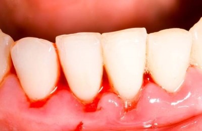 BB51FBD682B04004B76A675A7F87C538_400x260.jpg BB51FBD682B04004B76A675A7F87C538_400x260.jpg