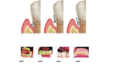 EB617EFE8DE44FD0AAE28AF63A37B510_400x225.jpg EB617EFE8DE44FD0AAE28AF63A37B510_400x225.jpg