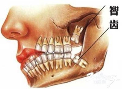 873863F22A284C82846B011ECD7569BB_400x291.jpg 873863F22A284C82846B011ECD7569BB_400x291.jpg