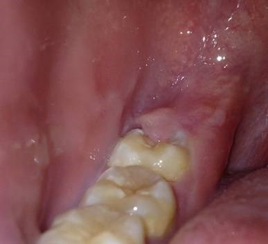 2A349951EDDF4F65A9FF589D7F2981DE_387x353.jpg 2A349951EDDF4F65A9FF589D7F2981DE_387x353.jpg