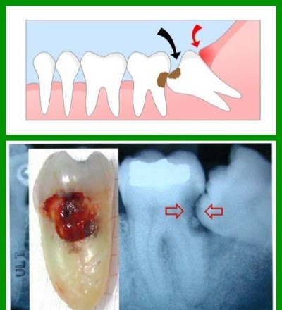 2017DCDDF6B544A3979DA4830BA2E435_400x440.jpg 2017DCDDF6B544A3979DA4830BA2E435_400x440.jpg