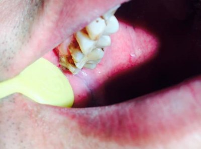 F438007EB6734F5D872E3A5EDA5B684A_400x297.jpg F438007EB6734F5D872E3A5EDA5B684A_400x297.jpg