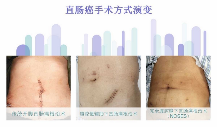 方式演变.jpg 方式演变.jpg