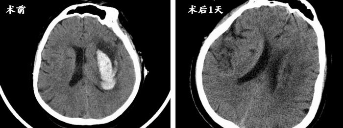 对比.jpg 对比.jpg