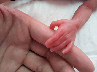 三等奖儿科病房大手托小手吴彦芳.jpg 三等奖儿科病房大手托小手吴彦芳.jpg